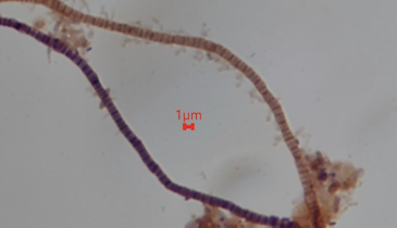 Bug of the Month: The Role of Staining in Filamentous Bacteria Identification