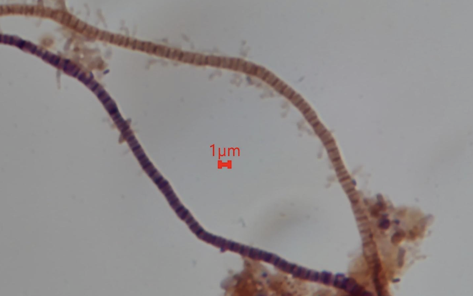 Bug of the Month: The Role of Staining in Filamentous Bacteria Identification