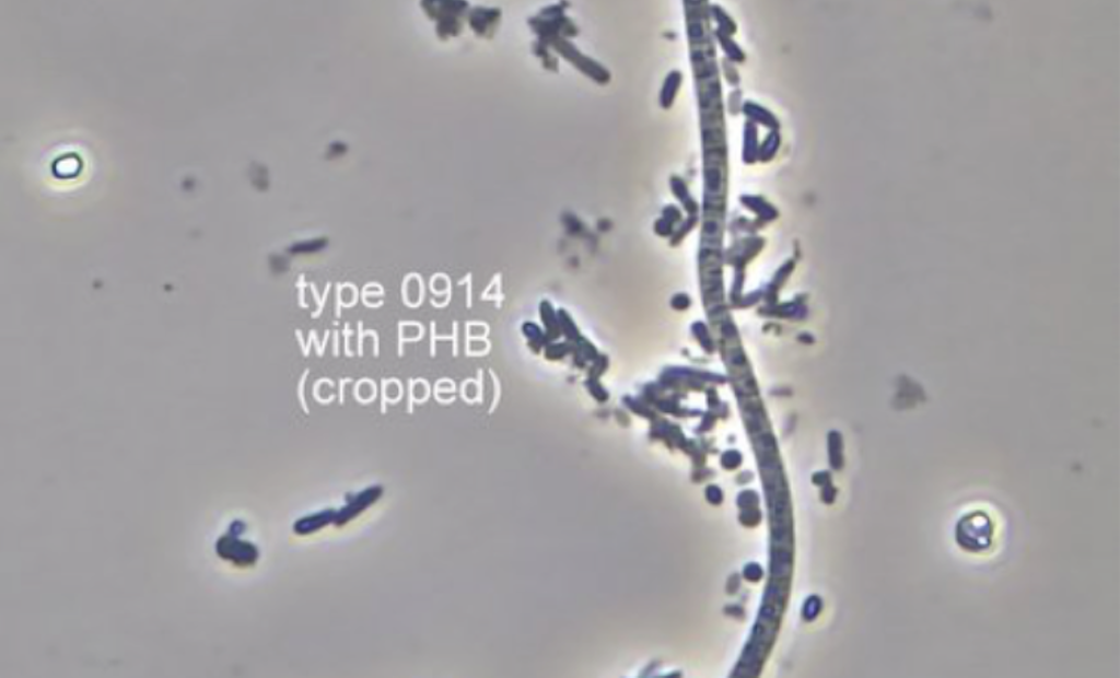 Bug of the Month: Filament Type 0914 and the Importance of Correct Diagnosis
