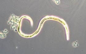 Bug of the Month: Nematodes and Wastewater Treatment Plants