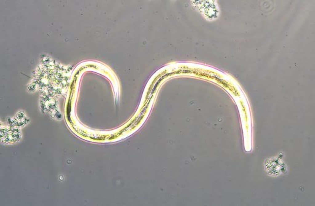 Bug of the Month: Nematodes and Wastewater…