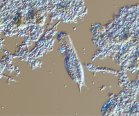 Bug of the Month: Gastrotrich, an Occasional WWTP Visitor