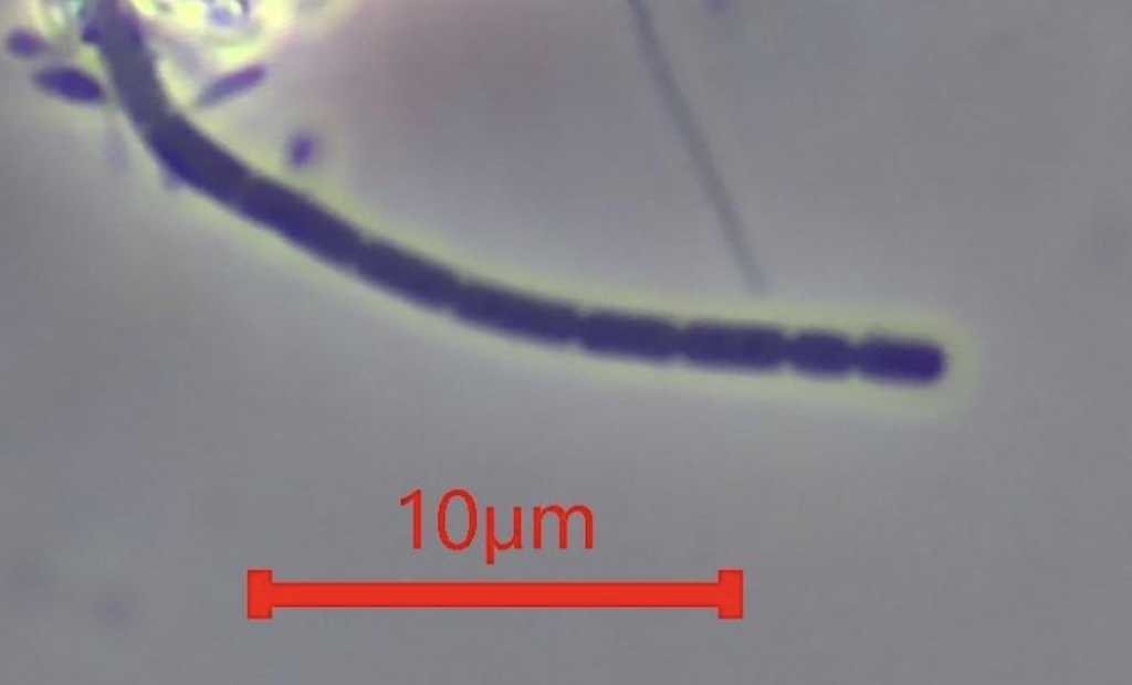 Bug of the Month: Learn About Type 1701 Filaments and Sludge Bulking