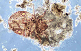 Bug of the Month: Water Mites Are Often a Sign of a Healthy WWTP