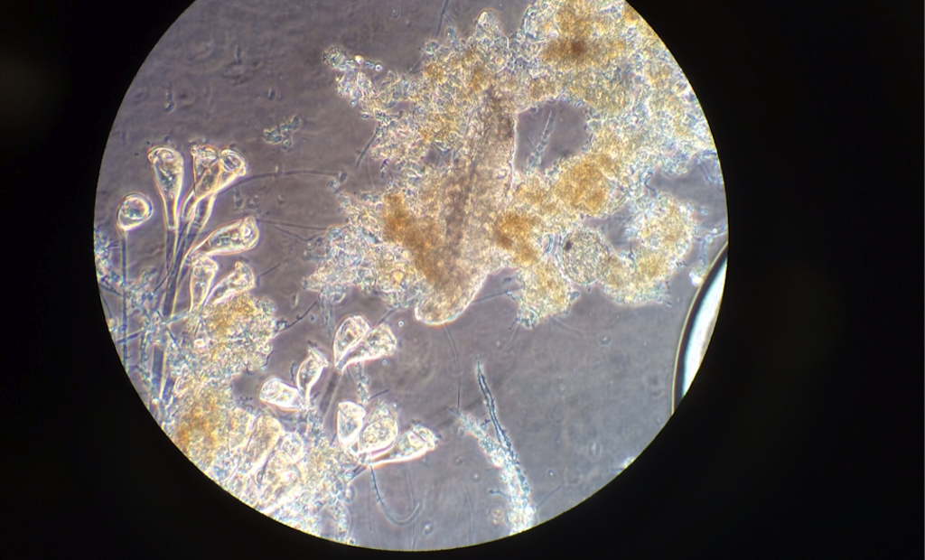 6 Photos of Creepy-Crawly Wastewater Microorganisms